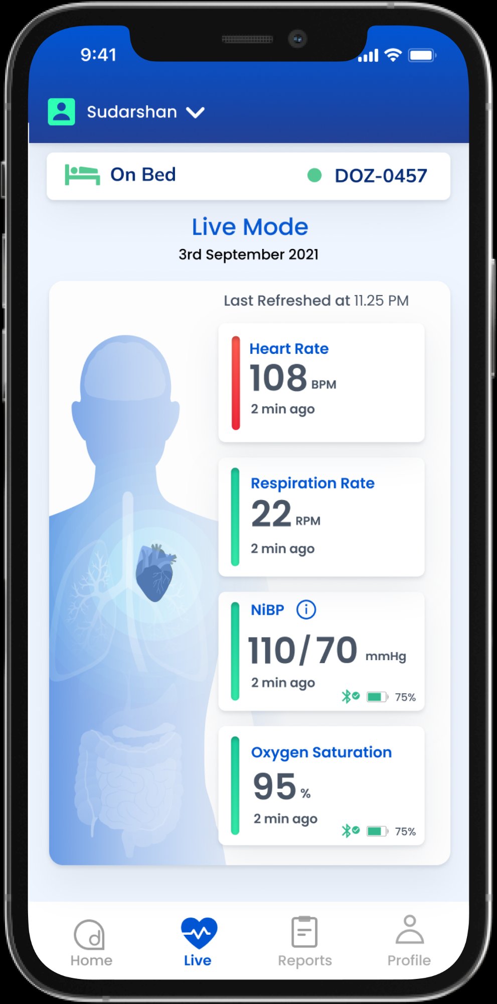 Dozee Home mobile app showing live vitals